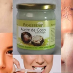 Los beneficios del aceite de Coco para la salud