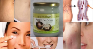 aceite-de-coco-barato